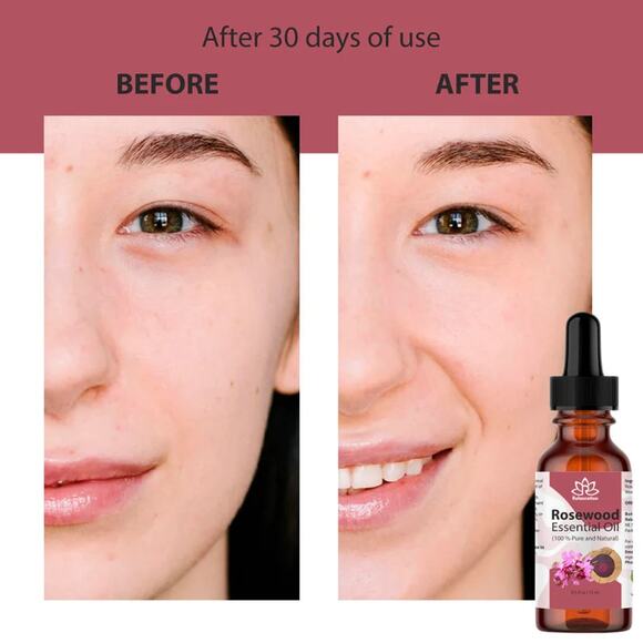 Rosewood Essential Oil in Amber Bottle - Picture 10 of 10